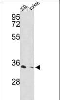 IHC-plus™ Polyclonal Rabbit anti-Human PSMD11 Antibody (aa288-317, IHC, WB)