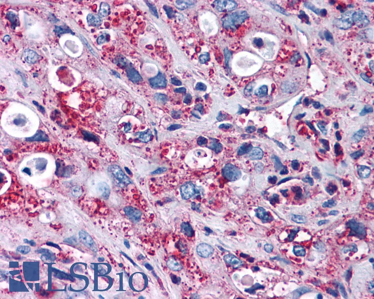 PathPlus™ Polyclonal Rabbit anti-Human FZD3 / Frizzled 3 Antibody (N-Terminus, IHC)