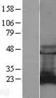 RAB9A / RAB9 Protein (Over-Expression Lysate Myc-DDK (Flag))