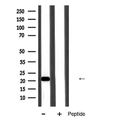 Polyclonal Rabbit anti-Human CSRP1 Antibody (IHC, WB)