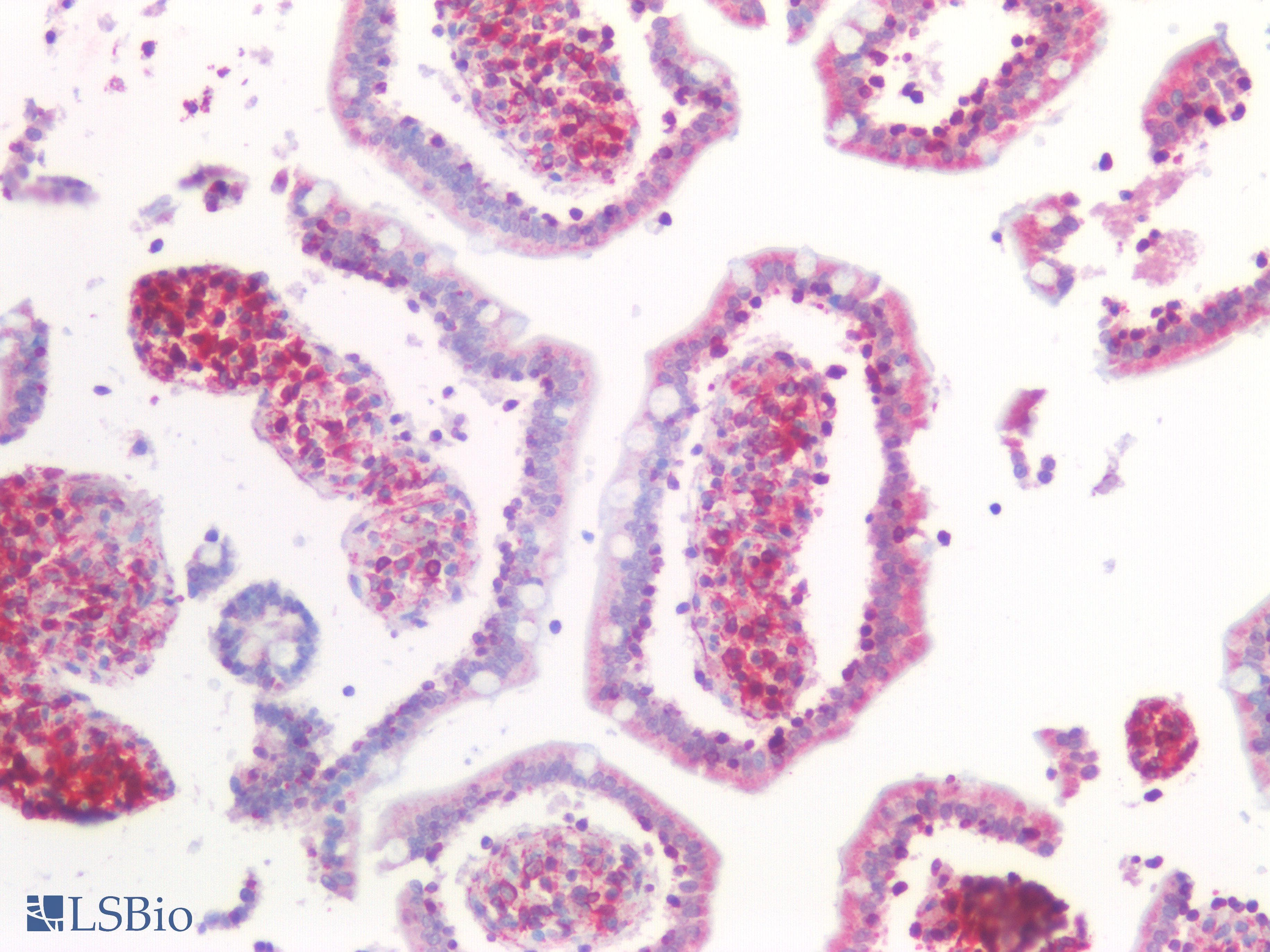 IHC-plus™ GPC3 / Glypican 3 Antibody (clone 2C12)