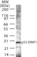 SIP / TP53INP1 Antibody