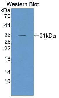 VARS / ValRS Antibody