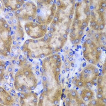 Polyclonal Rabbit anti-Human Osteonectin / SPARC Antibody (IHC, WB)