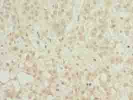 MFSD8 Antibody