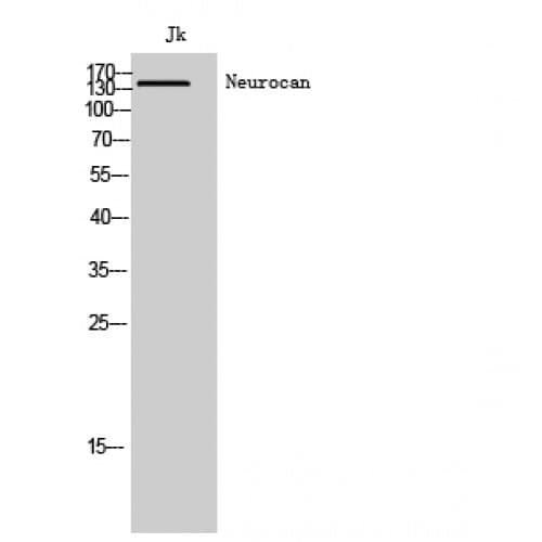 NCAN / Neurocan Antibody (370-450 aa, Internal)