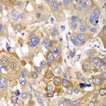 PPP1CB Antibody
