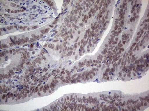 HDAC9 Antibody (aa181-460, clone OTI5B8)