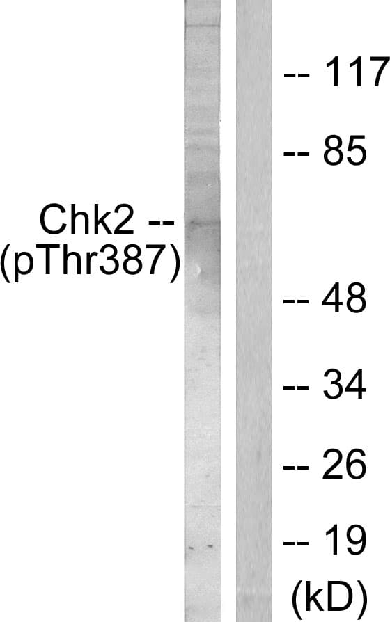 CHEK2 / CHK2 Antibody (phospho-Thr387)