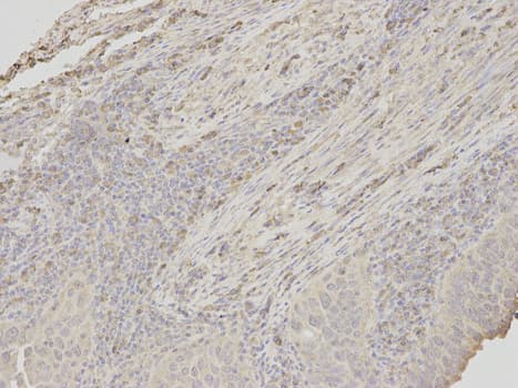 APOM / Apolipoprotein M Antibody