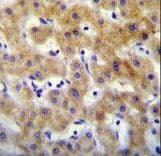 KRTCAP2 Antibody (aa134-162)