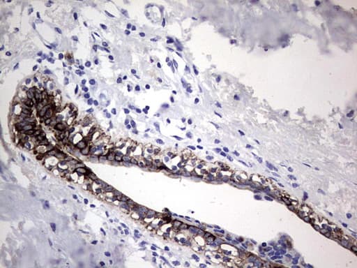 Monoclonal Rat anti-Human Acidic Cytokeratin Antibody (clone 9H3, IHC)