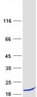 Human UFC1 Protein (Recombinant Myc-DDK (Flag))