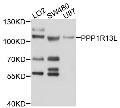 PPP1R13L / iASPP Antibody