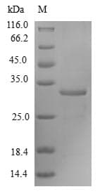 Human FOXM1 Protein (Recombinant 10His-SUMO, N-terminus + Myc, C-terminus)