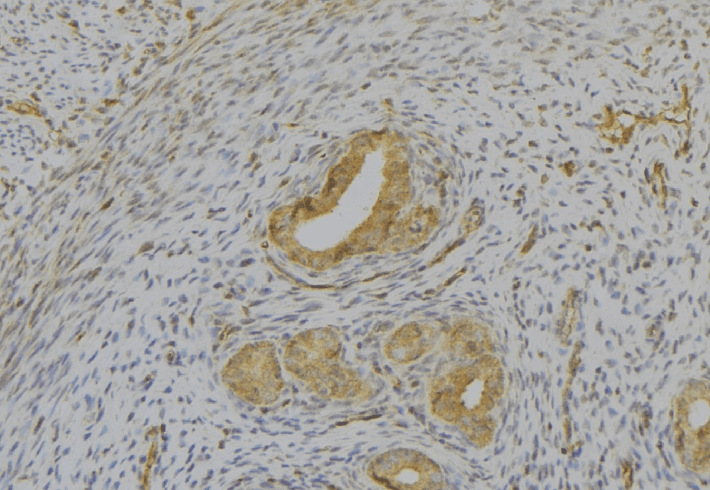Polyclonal Rabbit anti-Human IL1A / IL-1 Alpha Antibody (IHC, WB)