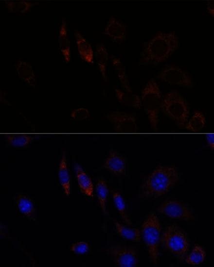 RNF112 / ZNF179 Antibody