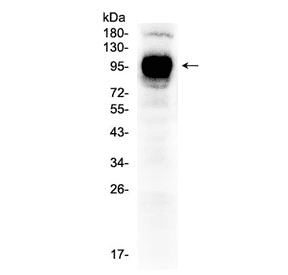 CD119 / IFNGR1 Antibody