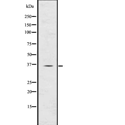 TIRAP Antibody