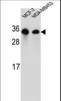 Polyclonal Rabbit anti-Human SARA2 / SAR1B Antibody (aa89-116, IHC, WB)