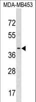 PAFAH2 Antibody (aa249-276)