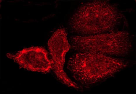 GRM5 / MGLUR5 Antibody