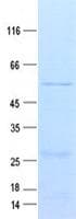Human TMEM123 / Porimin Protein (Recombinant GST, N-terminus + His, C-terminus)