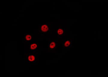 Polyclonal Rabbit anti-Human UHRF1 Antibody (IHC, IF, WB)