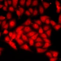 CHAF1B / CAF1 Antibody