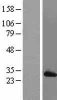 MAD2L1 / MAD2 Protein (Over-Expression Lysate Myc-DDK (Flag))