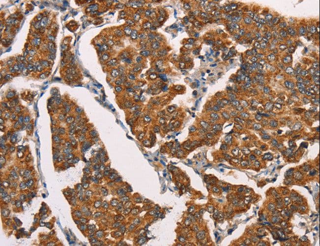 SPR Antibody