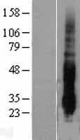 DUSP14 Protein (Over-Expression Lysate Myc-DDK (Flag))