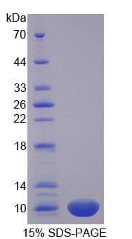 Human PRM1 / Protamine 1 Protein (Recombinant His, N-Terminal)