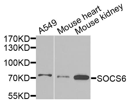 Polyclonal Rabbit anti-Human SOCS6 / SOCS-6 Antibody (WB)