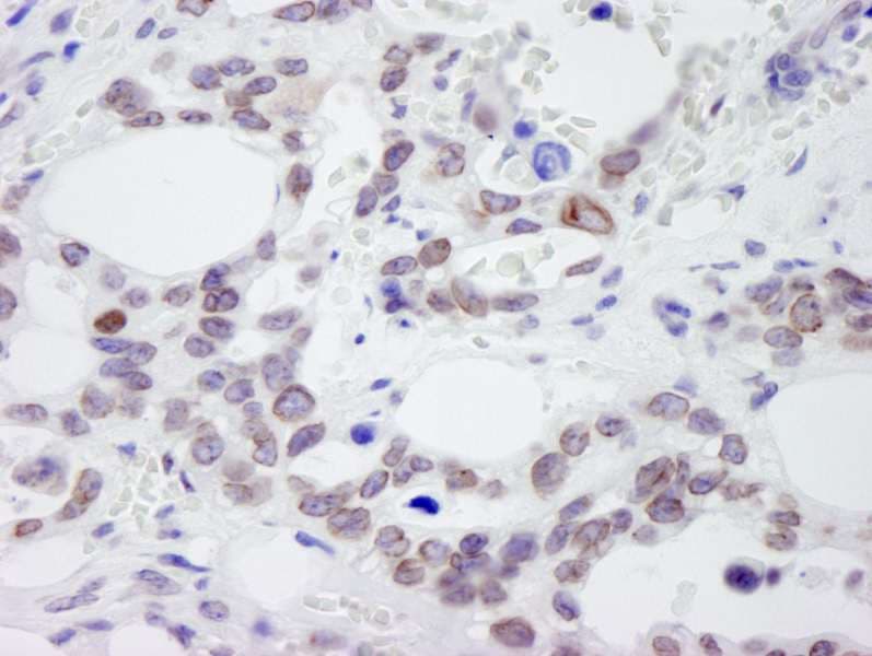 NUP214 / CAN Antibody (aa1250-1300)