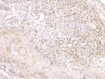 SRCIN1 / SNIP Antibody