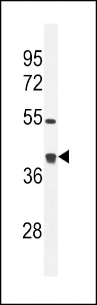 IHC-plus™ GLRX3 / Glutaredoxin 3 Antibody (aa81-110)