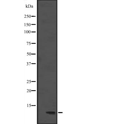 Polyclonal Rabbit anti-Human DYNLL1 / PIN Antibody (WB)
