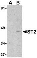 IL1RL1 Antibody