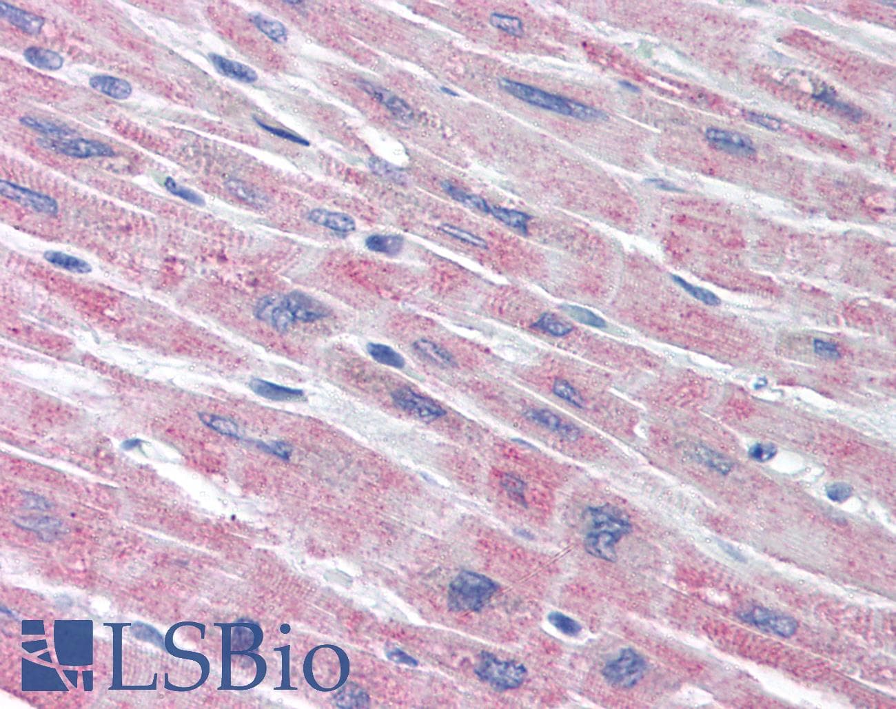 IHC-plus™ PLA2G5 Antibody (clone MCL-3G1)