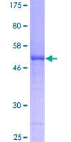 Human ICK Protein (Recombinant GST)