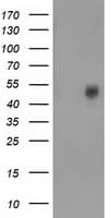 VMD2L3 / BEST3 Antibody (clone OTI1H5)