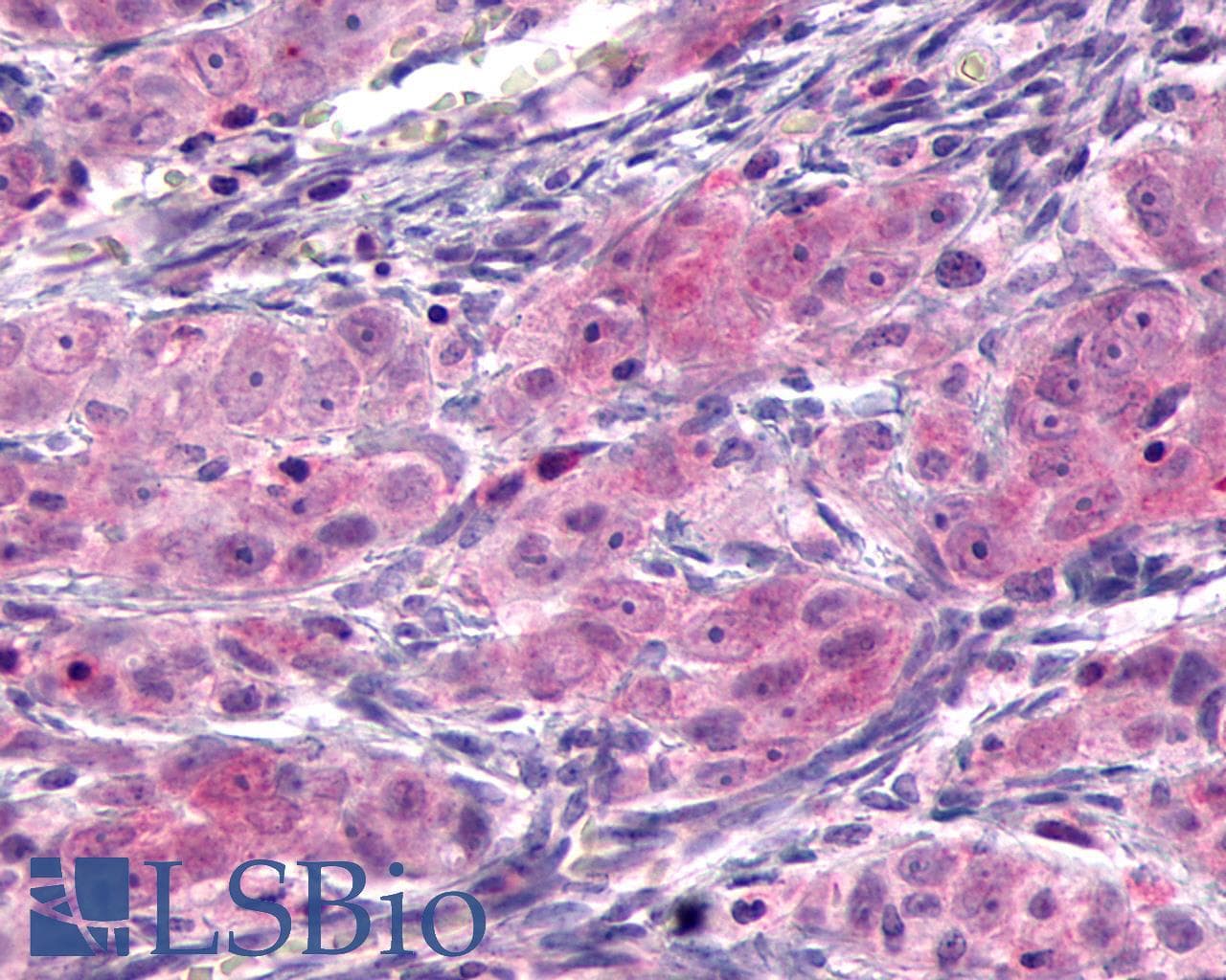PathPlus™ SSTR3 Antibody (C-Terminus)