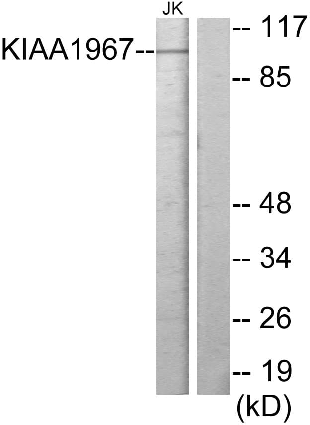 Polyclonal Rabbit anti-Human CCAR2 / KIAA1967 Antibody (aa431-480, WB)
