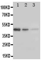ERBB3 / HER3 Antibody (aa162-181)