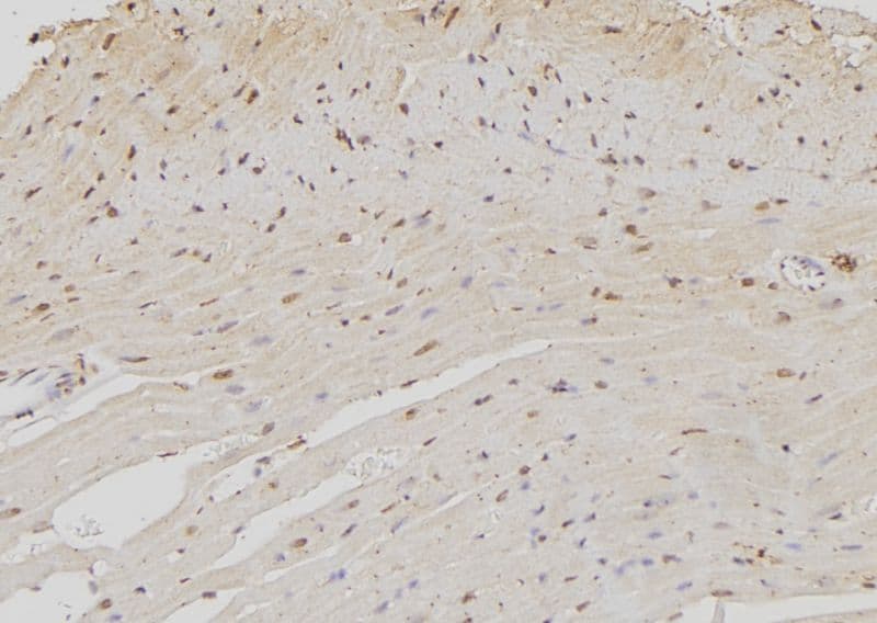 Polyclonal Rabbit anti-Human NOC4L Antibody (IHC, WB)