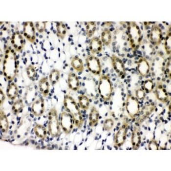 PTPN2 / TC-PTP Antibody (aa1-330)