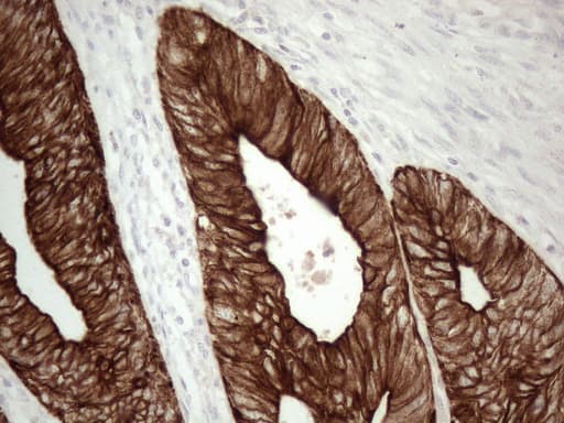 KRT16 / CK16 / Cytokeratin 16 Antibody (clone OTI2H8)