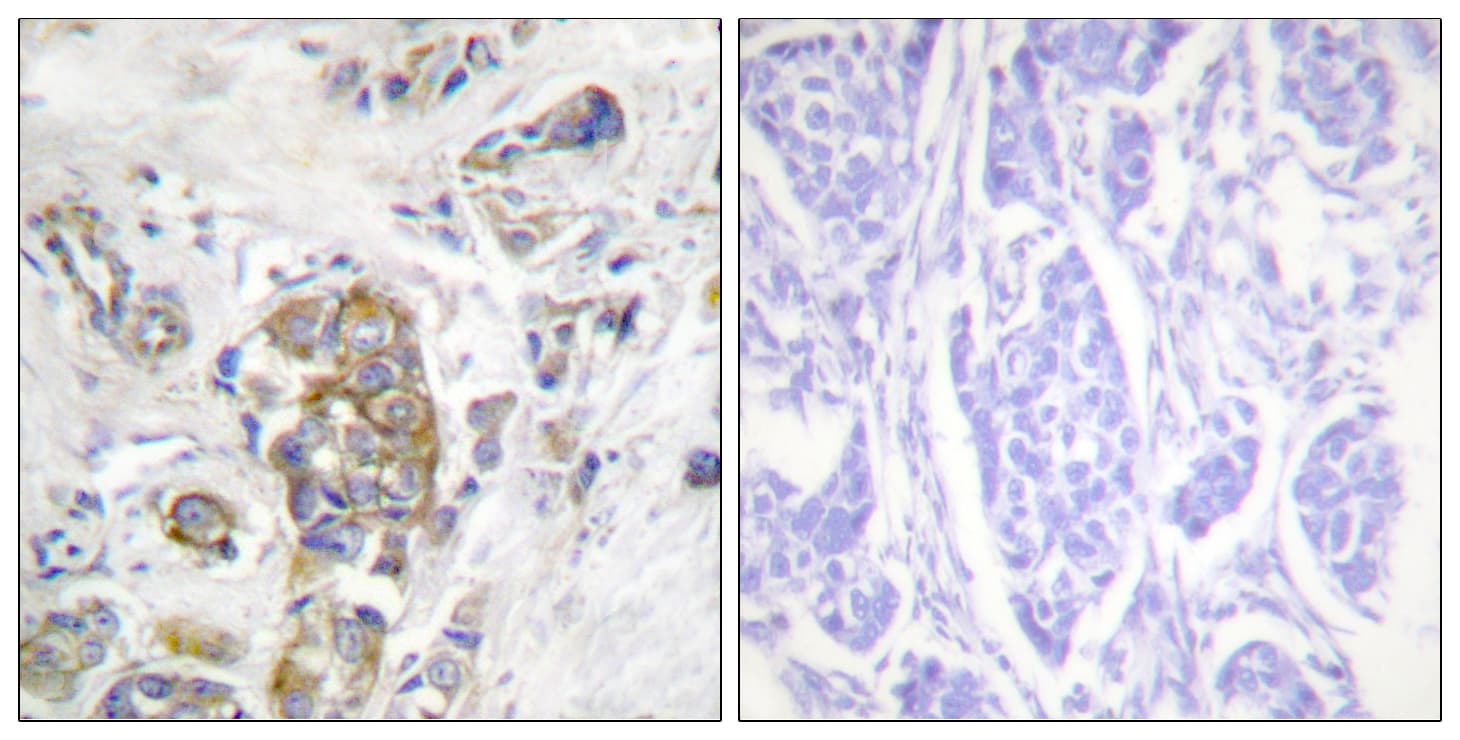 ITGB4 / Integrin Beta 4 Antibody (phospho-Tyr1510)