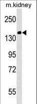 CASC5 Antibody (aa1557-1583)